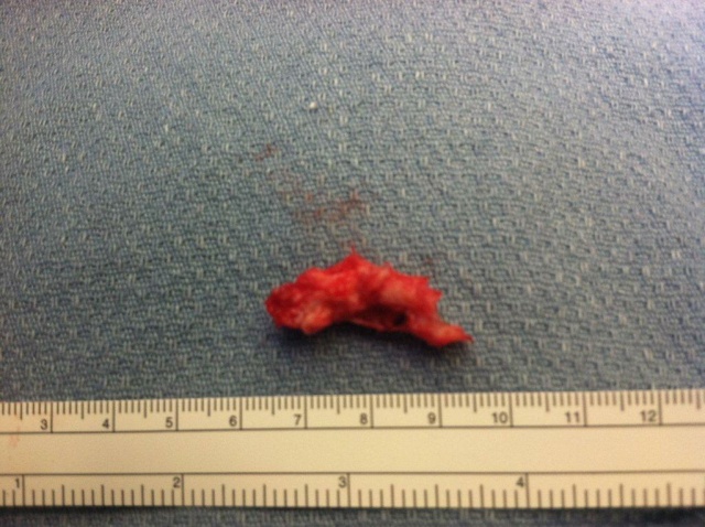 [lang:en]Removed Disc Part[lang:sk]Odstr�nen� �as� platni�ky